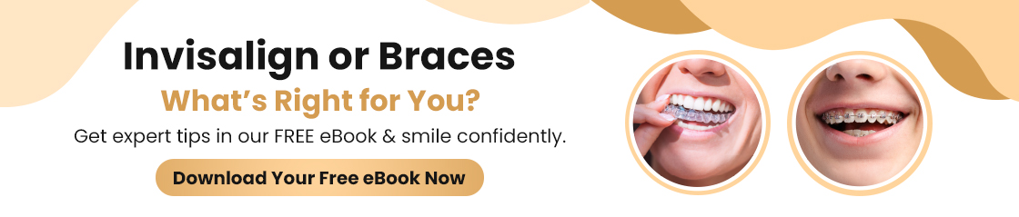 Invisalign_or_braces_what_is_right_for_you
